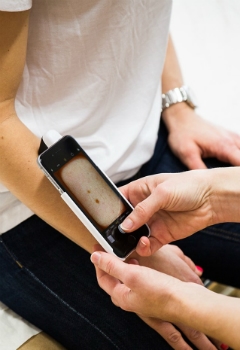 hudforandring_2.jpg
